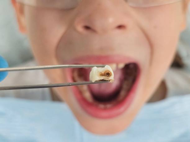 Best Same-Day Emergency Dental Services in Clendon, AR